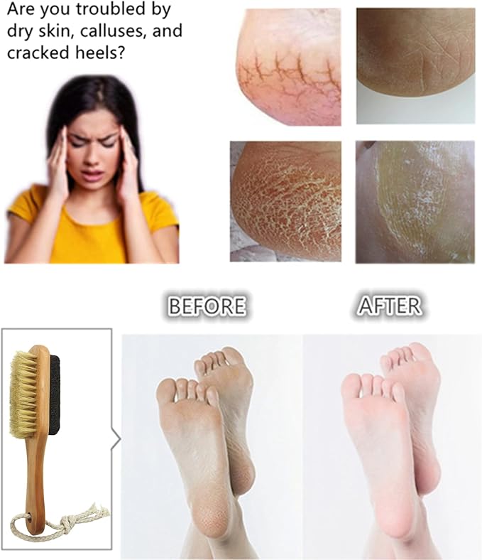 Natural Lava Pumice Stone for Feet with Foot Brush, Callus Remover Foot Scrubber Exfoliator Pedicure Tools for Hard Dead Skin, Softer & Smoother Feet, Double Sided Boar Bristles Wooden Handle