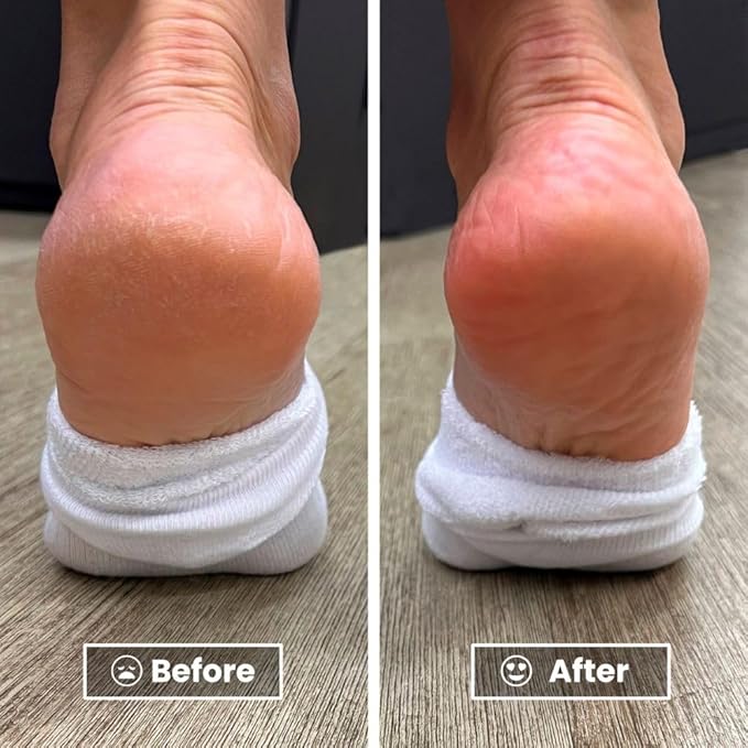 LONDONTOWN Pedikur Foot Balm Restorative Smoother Soles & Softer Heels, Vegan & Cruelty Free, 4 fl oz
