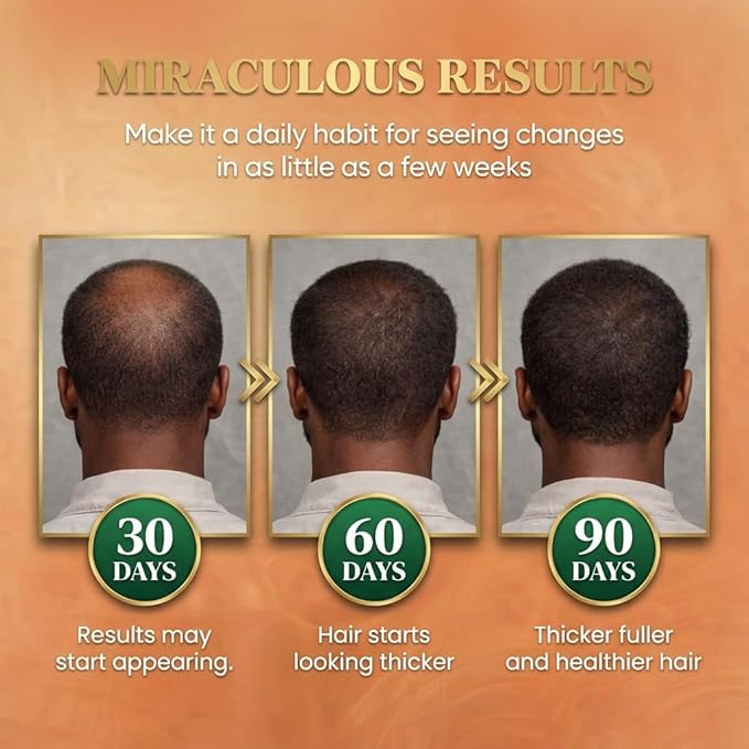 Batana Oil for Hair Growth Dr Sebi, 100% Raw Organic Batana Hair Mask from Honduras, Wild Growth Hair Oil, Scalp Oil Promotes Hair Thickness, Prevents Loss for Men & Women, 4.06 fl oz