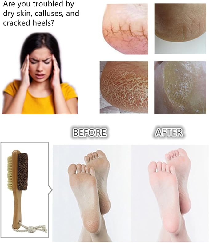 Natural Lava Pumice Stone for Feet with Brush, 2 Pcs Callus Remover Foot Scrubber Exfoliator Pedicure Tools for Hard Dead Skin, Smoother Feet, Double Sided Boar Bristles Wooden Handle, Random