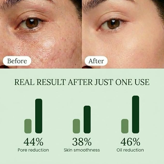 QUIA Toner Pads – AHA/BHA Dual-Action Exfoliate and Hydrate All in One – Soothing Formula for Sensitive Skin – Reduces Blackheads and Blemishes- 70 Gentle Textured Pads – Korean Skincare