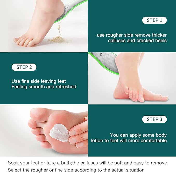 MR.GREEN Foot File Double Sided Pedicure Foot Care Tools Professional Callus Remover Foot Rasp Stainless Steel Foot Scrubber for Feet (Green)