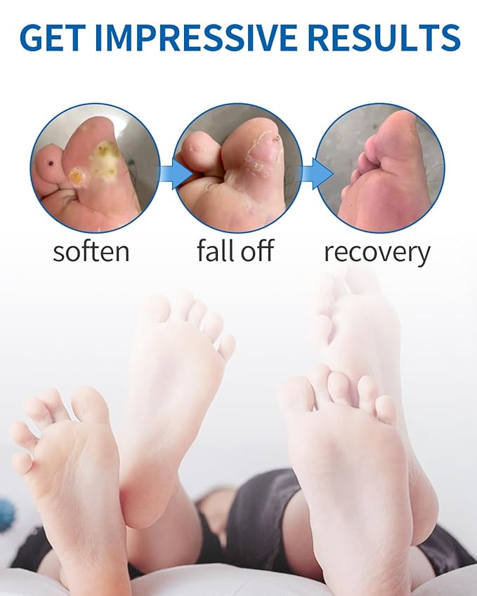 MQ Professional Corn & Callus Remover Liquid for Feet & Toes – Fast Acting for Corn Removal, Hard Skin & Dead Skin – Includes 15ML Solution + 15 Cushions + 10 Swabs – Effective Foot Care Solution