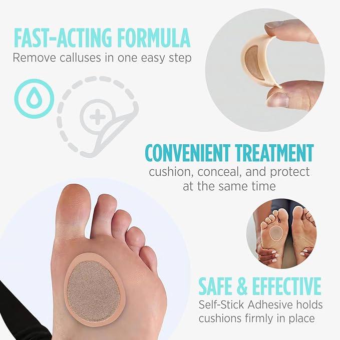 Comfort Zone Medicated Callus Patches for Feet, Effective Treatment with Salicylic Acid, 8 Medicated Patches and 12 Protective Callus Pads for Feet, 20 Piece