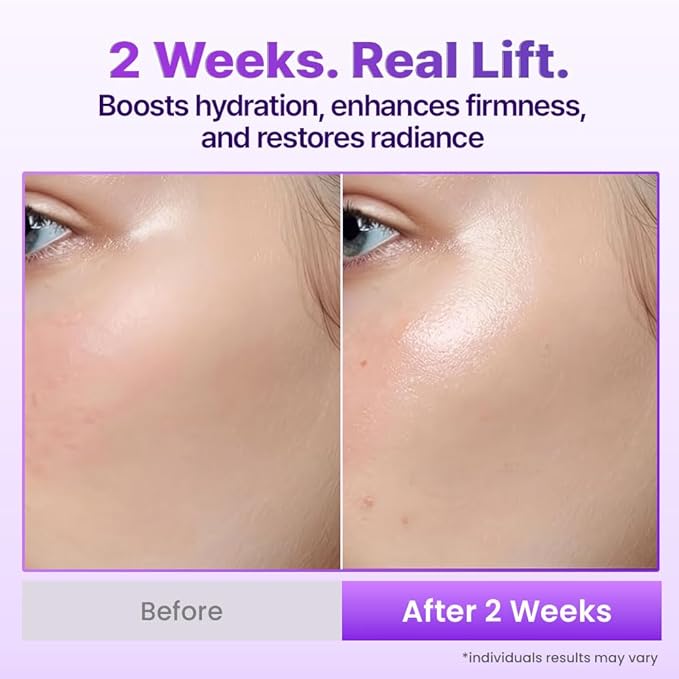 BIOHEAL BOH Probioderm 3D Lifting Cream Mist 3.38 fl oz | Korean Face Mist with Cream-Like Hydration for Instant Glow, Firm-Looking Skin & On-the-Go Refresh