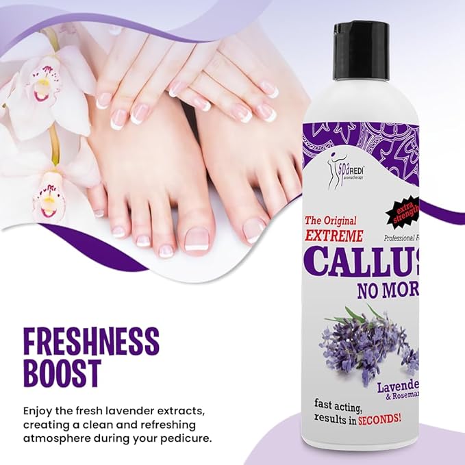 SPA REDI Callus Remover - Professional-Grade Callus Dissolving Treatment - Stop Scraping. Start Dissolving. Chemically Dissolve Toughest Buildup for a Dramatic 'Wow' Transformation 12 Oz