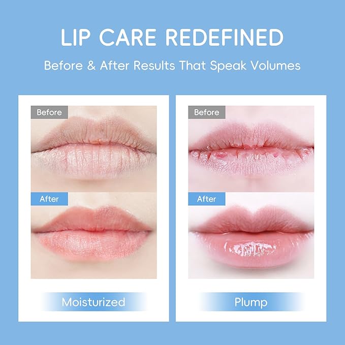 AKARY Milk 5 Pcs Moisturizing Lip Mask, Lip Sleep Gel Pads Mask Bulk for Moisturizing, Patches Let Skin Smoothing, Exquisite, Remove Dead Skin, Keep Plump & Wrinkle, for Dry or Chapped Lips (5)