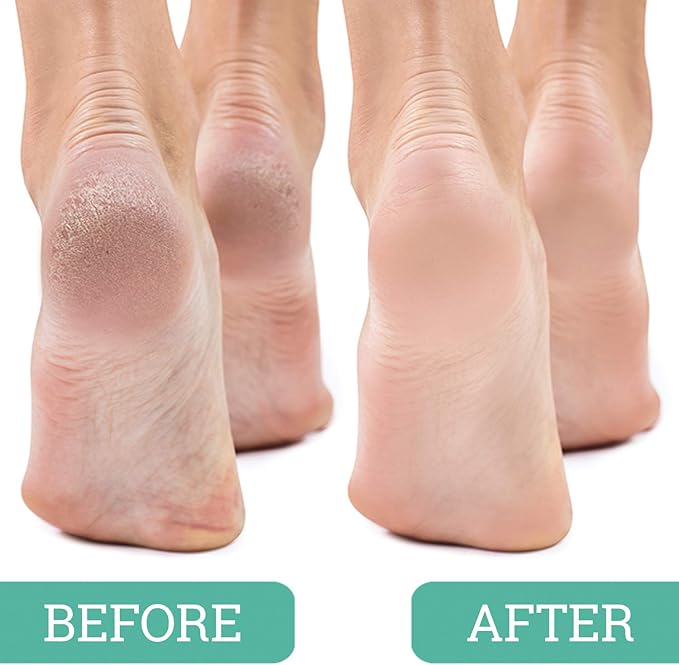Maccibelle Salon Foot Pumice and Scrubber for Feet and Heels Callus and Dead Skins, Safely and Easily Eliminate Callus and Rough Heels (Pack of 1)