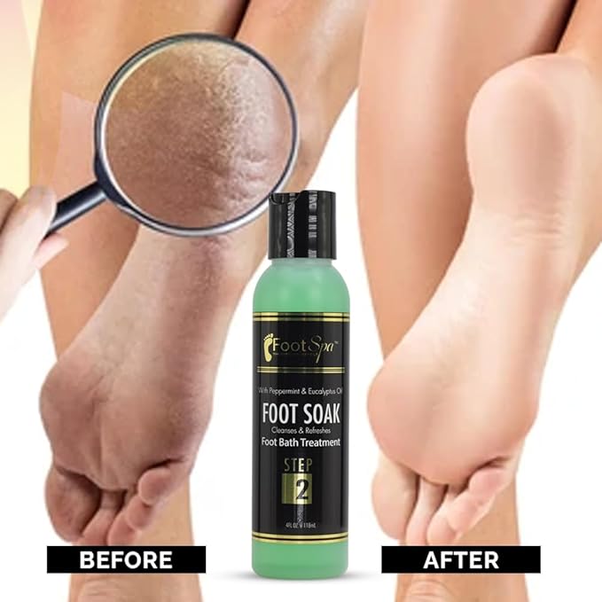 FOOT SPA - Foot Soak, Cleanses, Softens, and Refreshes - Made with Eucalyptus and Peppermint Oil – 4 Oz