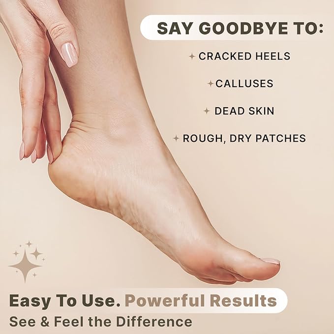 Beauty by Earth Pumice Stone for Feet - Natural Lava Stone Foot Exfoliator, Callus Remover, Foot Scrubber, Cracked Heels Solution, Strong & Durable Design for Smooth & Soft Feet