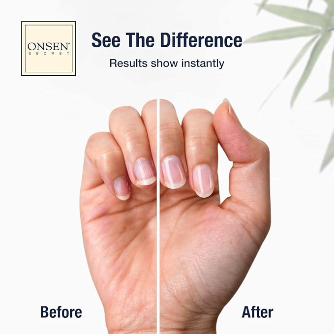 Onsen Secret Nail Care Kit - w/Cuticle Care Serum, Japanese Nail Buffer and Shine Kit - Strengthening & Shining - Spa-Quality Manicure - Organic Ingredients - Long-Lasting Shine - Easy & Safe - 1pk
