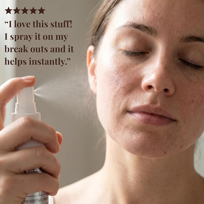 Pure Relief Rescue Spray for Sensitive, Irritated & Blemish-Prone Skin – Soothing & Gentle Facial Mist for Redness, Irritation, & Post Treatment – Hypochlorous Acid Spray for Face & Skin – 4 oz