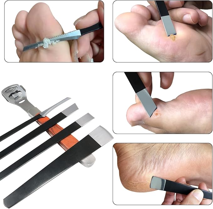 36 Pcs Callus Shaver for Feet Set, Foot Callus Shaver, (1 Stainless Foot File &1 Foot File Heads & 4 Pedicure Knife & 30 Replacement Slices Blades)
