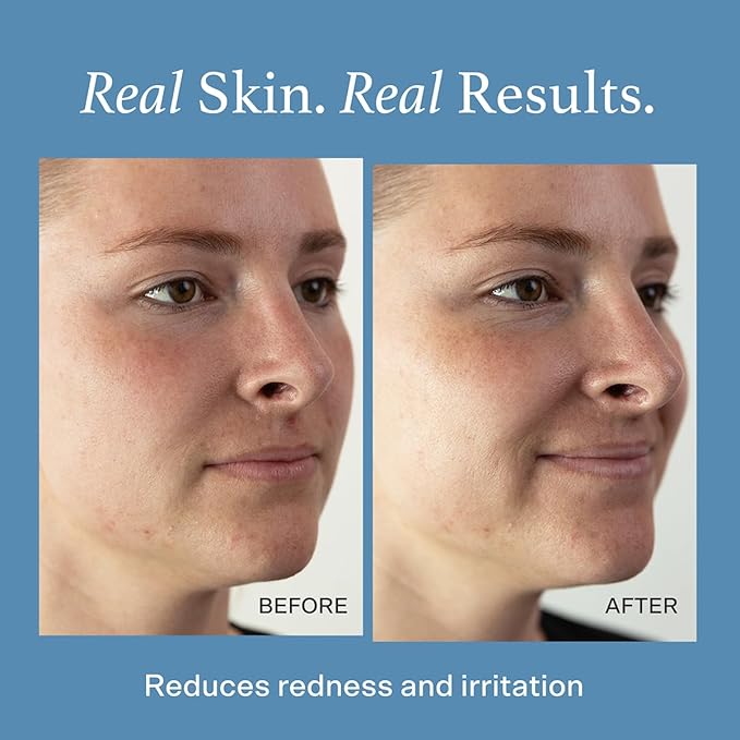 Otella Detox & Soothe Face Mist with Hypochlorous Acid .02% | 2.7 oz | Helps Reduce Redness, Irritation, Breakouts | Rosacea, Eczema, Sensitive-Skin Safe | Barrier Protecting & Skin Cleansing Toner