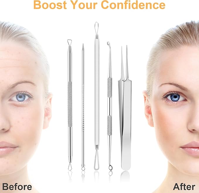 UUBAAR 9PCS Blackhead Remover Tools, Pimple Popper Tool Kit with 2 Tweezers, 304 Stainless Steel Comedone Extractor, 16 Precision Heads Face Nose Acne Zit Removal, Home Esthetician Use & Leather Case