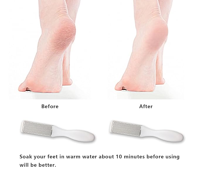Professional Foot Files Callus Remover,Foot Scrubber for Dead Skin,Stainless Steel Foot Rasp-White(1 Pack)