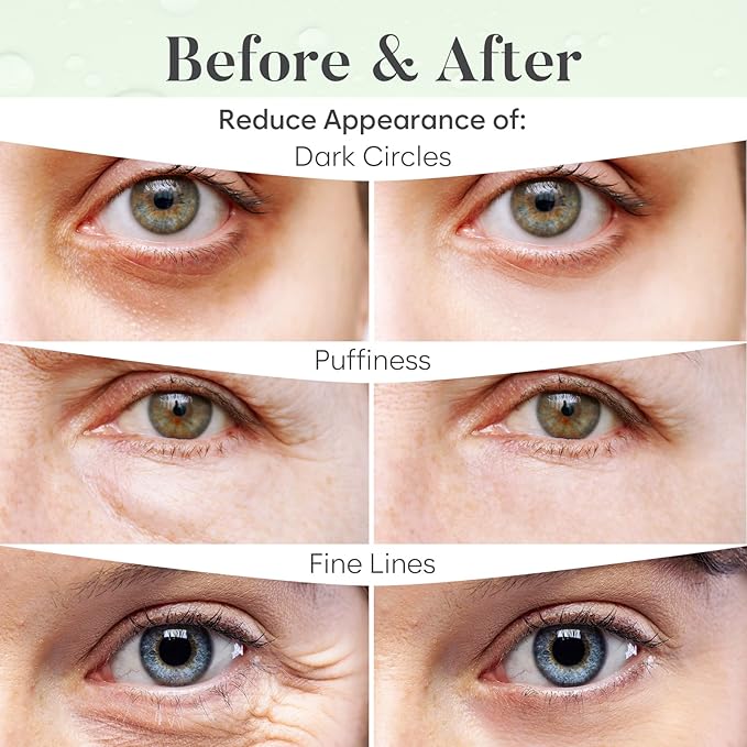 BLOOMORA Green Tea Under Eye Patches (20 Pairs) - Dark Circles & Puffiness Care - Hydrating Green Tea Eye Mask