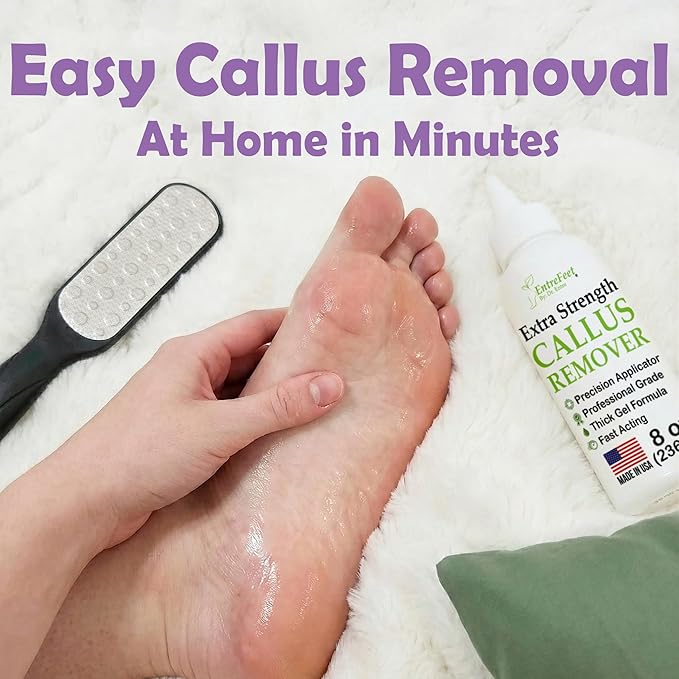 Callus Remover Gel & Double-Sided Foot File: 8 oz Extra Strength Callus Remover for Feet, Foot Callus Remover Care, Pedicure Tools Supplies, Spa Kit, Dead Skin Scrubber