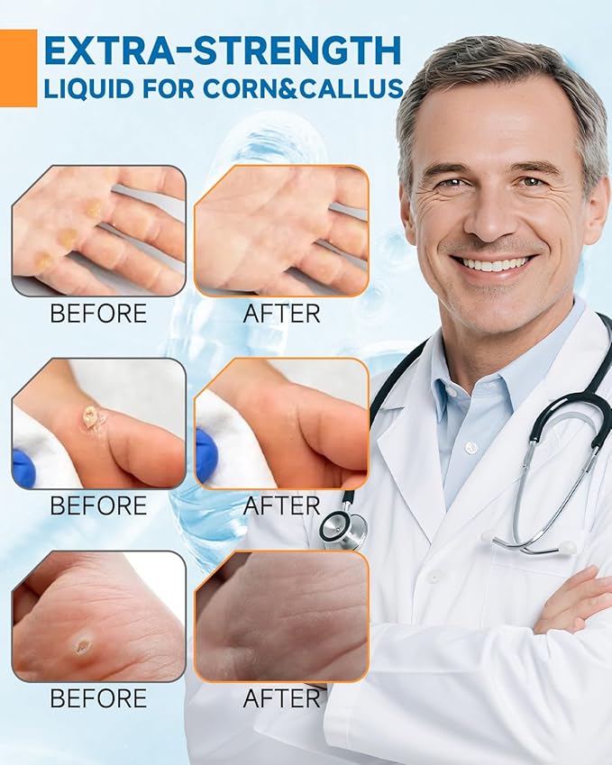 MQFORU Liquid Corn & Callus Removers for Toes & Feet, Extra Strength Corn Removal Fast Acting, 0.5 Fl oz + 15 Corn Cushions + 10 Swabs, Effective Foot Care Solution