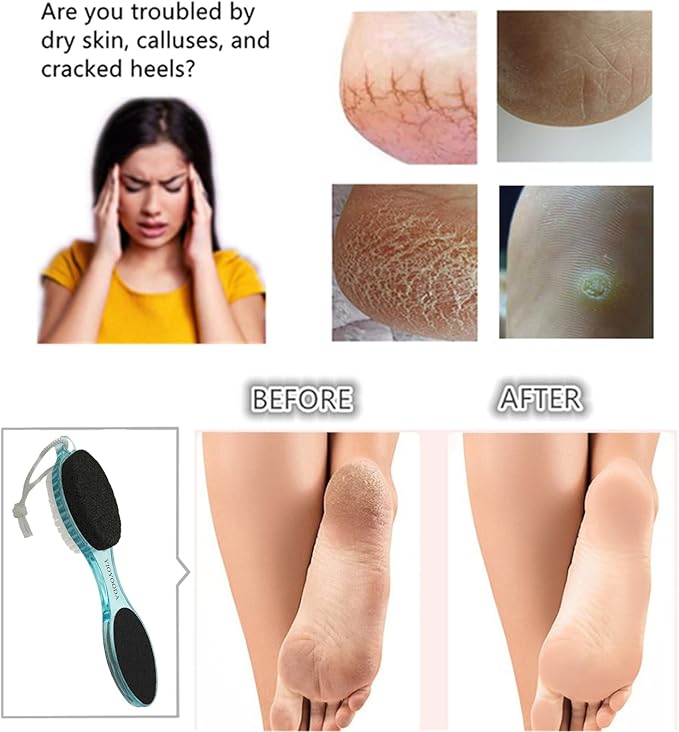 Foot File Callus Remover 4-in-1, Feet Scraper Pedicure Tools with Pumice Stone, Scrubber Brush, Foot Rasp and Sand Paper, Double Sided Multi Purpose, Clear Pink and Blue