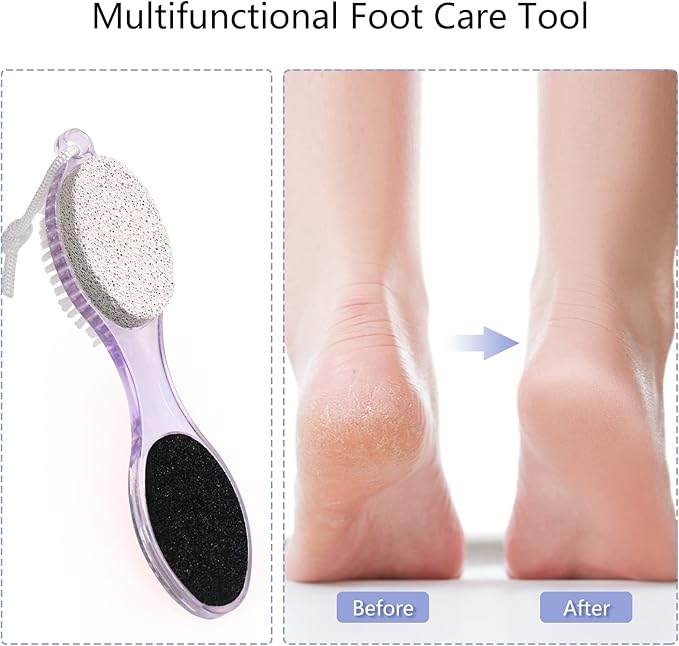 2-Pack 4 in 1 Pedicure Tool Callus Remover - Foot Scrubber with Pumice Stone, Cleaning Brush, Metal Rasp & Sandpaper for Dead Skin and Shower (Lilac and Blue)