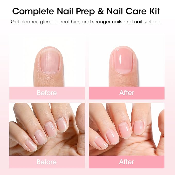 Gellen Nail Care Kit Manicure Tools Kit: Nail Strengthener and 2Pcs Nail File & Buffer 100/180, Cuticle Pusher Pen, Cuticle Oil & Remover, Fork | Nail Clipper & Brush