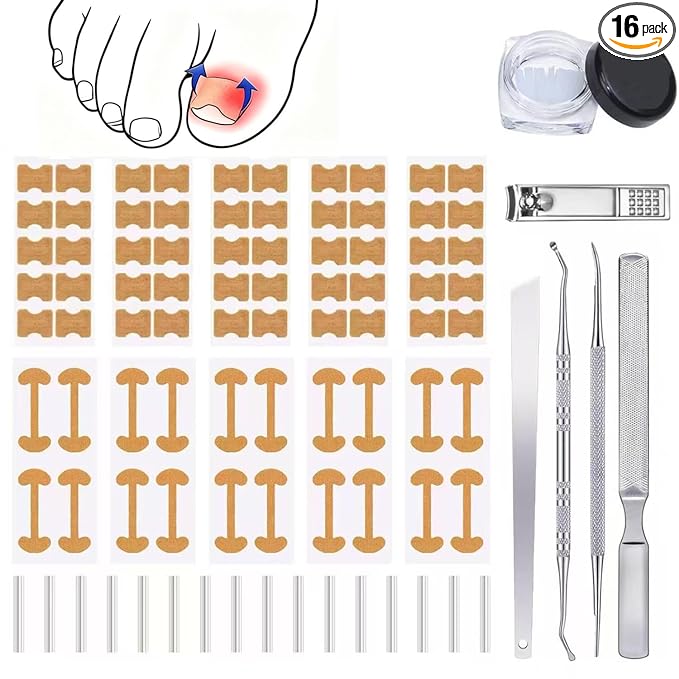 Ingrown Toenail Corrector Set with Correction Strips,Professional Ingrown Toenail Tool kit,Curved Toenails Corrector Patch,For Home Pedicure Care