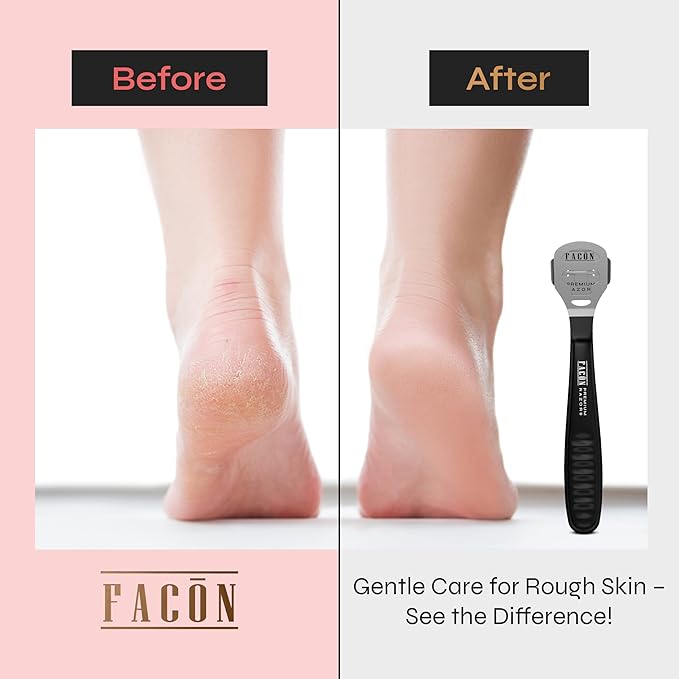 Facón Professional Callus Shaver Remover with 50 Blades, Pedicure Razor for Feet & Hands, Foot Razor for Callus Removal, Callus Blade Remover, Corn Shaver, Surgical Grade Premium Stainless Steel Tool