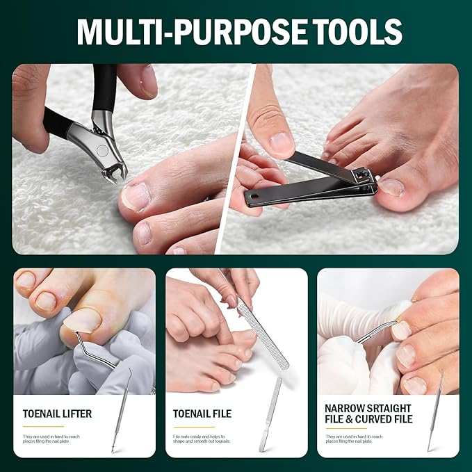 FVION Ingrown Toenail Tools Kit 5 Pcs, Toenail Clippers for Thick & Ingrown Nails, Ingrown Toenail Removal Correction Nail Clippers, Nail File Lifter, Professional Manicure Pedicure Tools