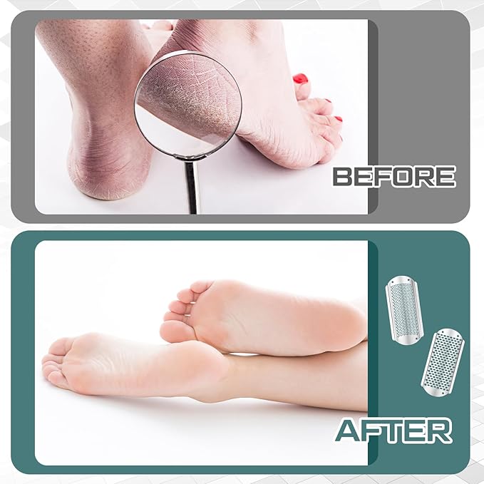 Moxweyeni 12 Pack Silver Foot File Callus Remover Replacement Blades Metal File Callus Remover Hard Skin Remove Stainless Steel 2 Designs Big/fine Hole for Detachable Foot Scrubber