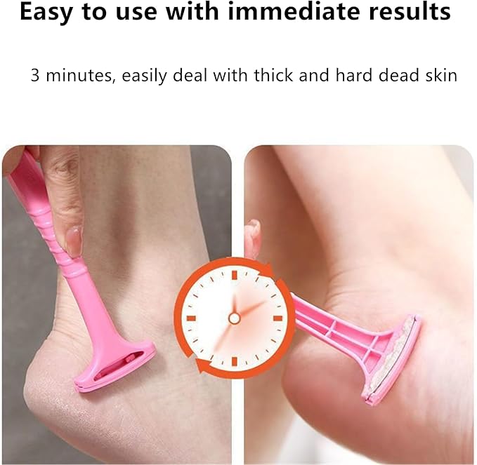 Pedicure Foot File, 4 Pcs Portable Foot Scrubber Foot Files Callus Remover Feet Dead Skin Removal Tool, Hard Skin Removers Pedicure Rasp for Dry Feet