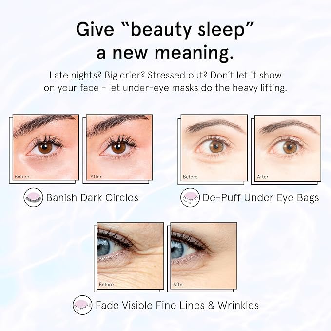grace & stella Retinol Under Eye Patches for Puffy Eyes and Dark Circles - Restoring Gel Under Eye Masks with Hyaluronic Acid - Vegan Skincare, Mothers Day Gifts Bulk (Purple, 48 Pairs)