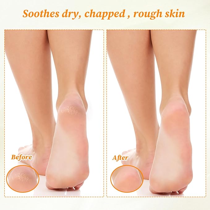 6 Pairs Moisturizing Socks Gloves Set, Spa Foot Moisturizer Socks & Cotton Lotion Gloves for Overnight Hydration, Repair Dry Hands & Feet, Rough Cracked Skin Treatment(Each 3)