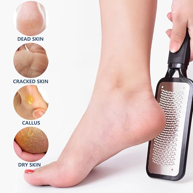 2 Pack Colossal Foot Files Kit Callus Remover Stainless Steel Dual Sided Foot Rasp Heel Scrubber Files Pedicure Tools