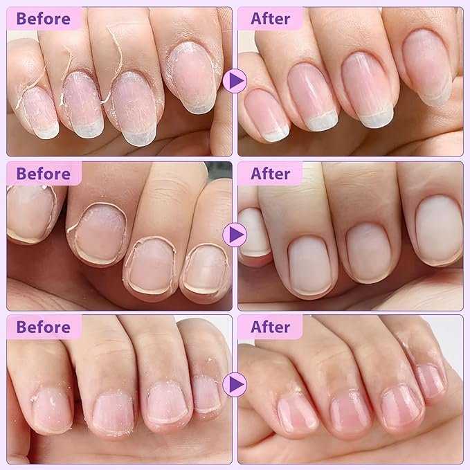 4-in-1 Cuticle Pusher & Oil Pen with Natural Oils, Cuticle Remover, Gentle Exfoliating Treatment, Moisturize, Strengthen & Brighten Nails, Complete Cuticle Care Tool (1)