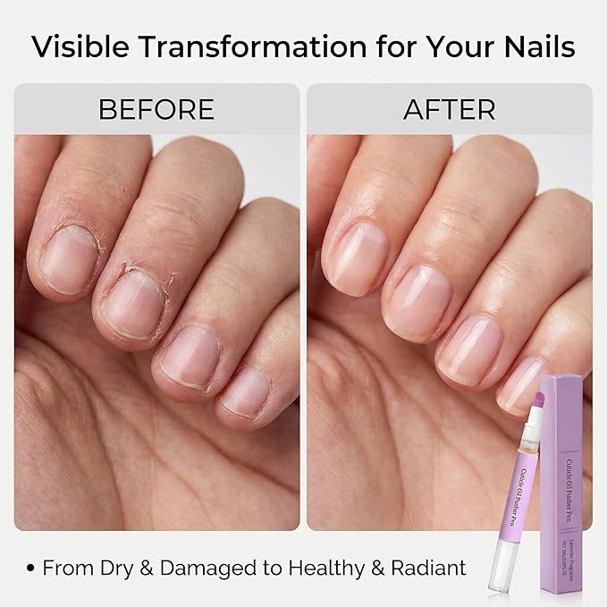 Ceramic Cuticle Pusher & Nail Oil Pen, 2-in-1 Nail Care Tool, Gentle Hangnail Remover for Dry or Damaged Nails, Portable Pen with Stainless Steel Cuticle & Nail Cleaner