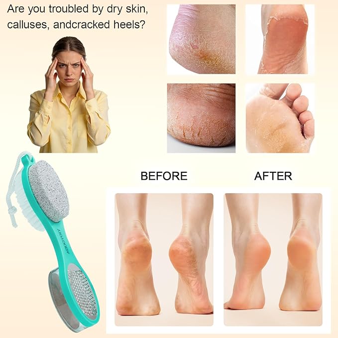 Foot Scrubber Brush with Pumice Stone for Feet 5-in-1, 3Pcs Foot File Callus Remover Pedicure Tool, Stainless Steel Feet Scraper, Cleaning Brush & Sand Paper Debris Catcher, Soft Smooth Feet