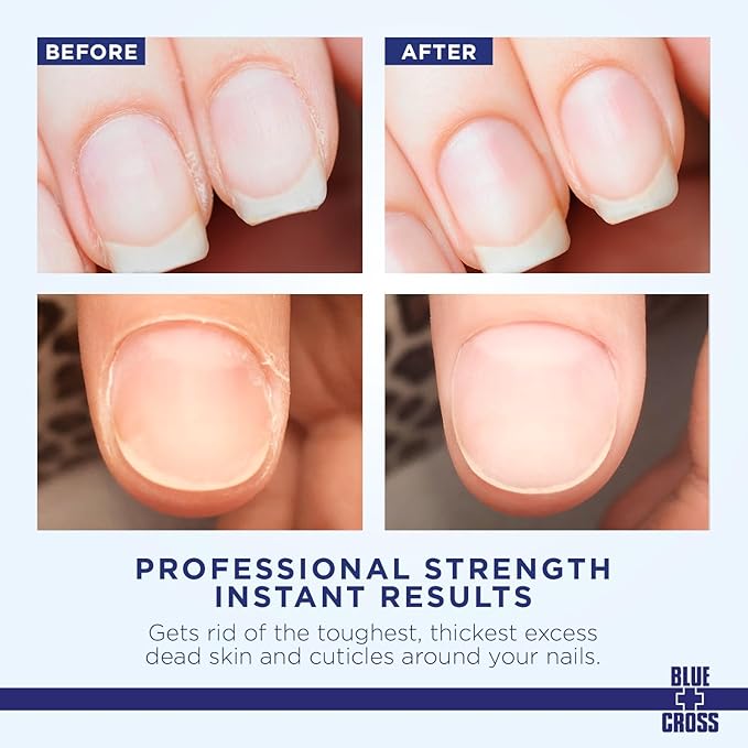 Cuticle Remover & Softener Liquid for Nails – Blue Cross Professional Nail Care with Lanolin, Hydrating Treatment for Dry Cuticles & Hangnails, Made in USA, 8oz