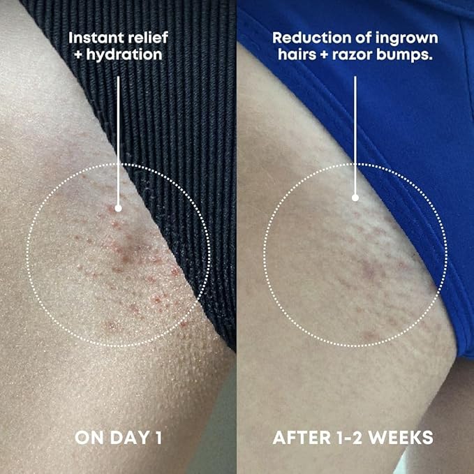 Bushbalm Ingrown Hair Exfoliating Scrub - Reduces Appearance of Ingrown Hairs and Razor Bumps, Soothes Skin and Post-Shave Redness - Nude, 236 ml