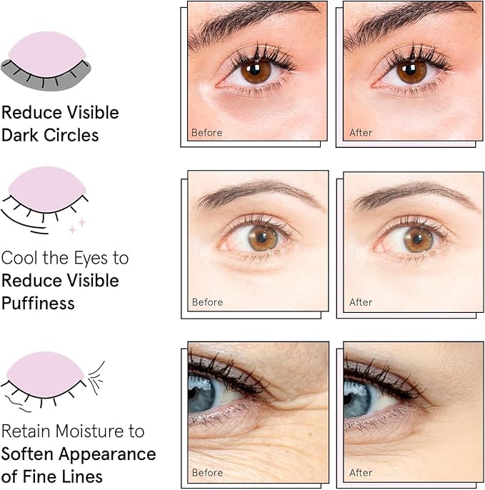 grace & stella Under Eye Patches (12 pairs) Eye Masks for Puffy Eyes and Dark Circles - Graduation Gifts for Teens, Birthdays, Bachelorette Party Favors, Self Care Gifts for Women - Vegan Cruelty-Free