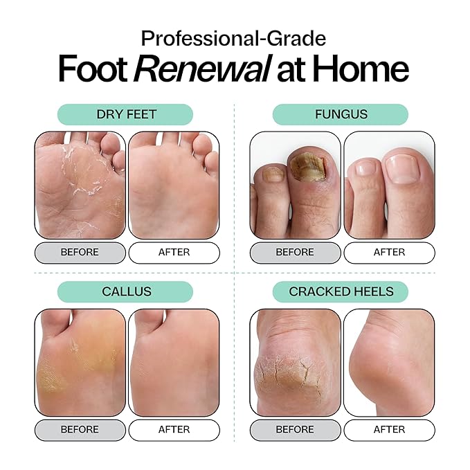Tea Tree Oil Foot Soak with Epsom Salt - For Toenail Repair, Odor Elimination & Softening Calluses - Soothes Tired, Sore Feet & Itchy Skin - Made in USA, 16 oz