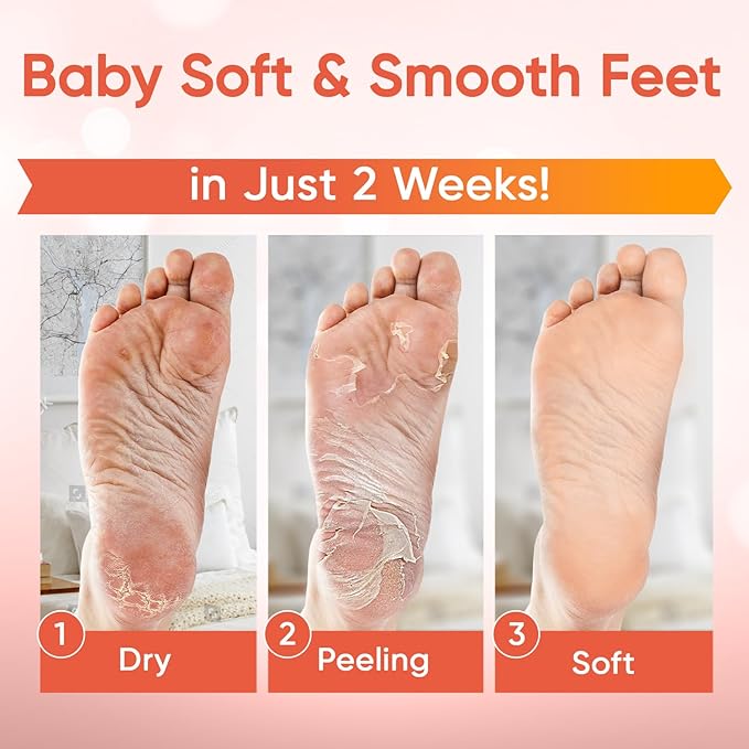 CÉLOR Foot Peeling Mask for Dry Cracked Feet | Foot Mask to Exfoliate Rough, Cracked, Dry Feet, Calluses for Soft Baby Feet Results | Made with Aloe Vera Extract for Women & Men (3 Pairs) | Peach