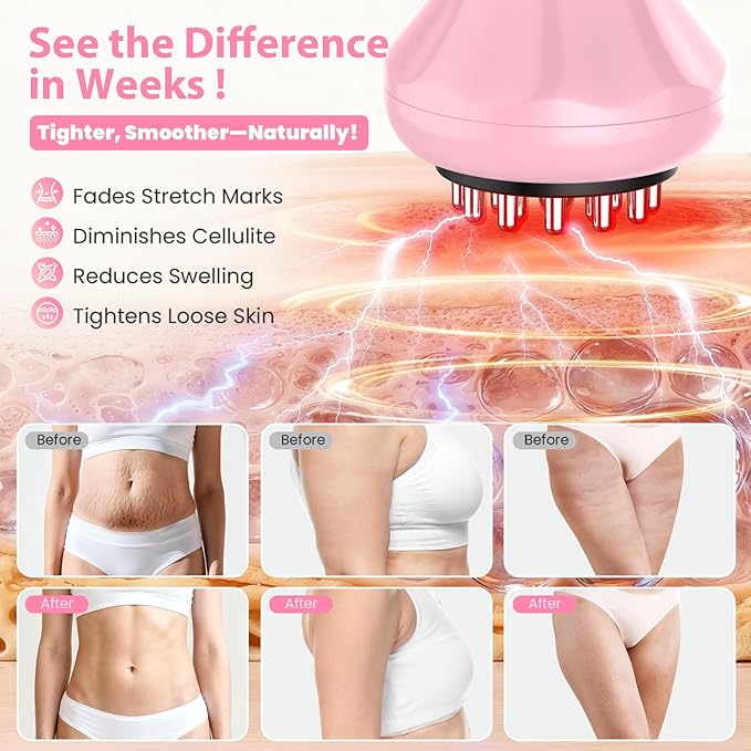 Lymphatic Drainage Massager, Anti Cellulite Massage Tool For Thigh & Belly Stretch Marks & Cellulite Reduction, Handheld Massage tools for Sciatica Nerve, Legs, Arms, Hip, Muscle, Low Back Pain Relief