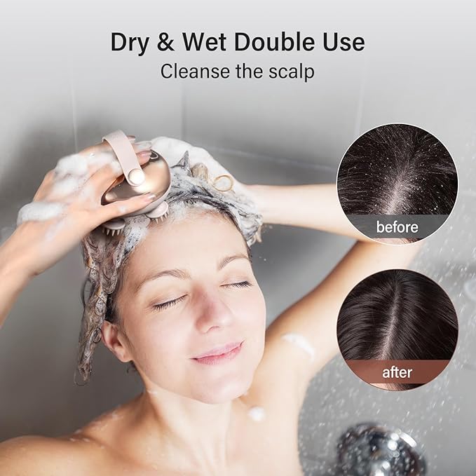 arboleaf Scalp Massager Kneading Head Massager Scalp Stress Relax Portable Rechargeable Hair Massager Shower Massage Waterproof Cat Massager Scratcher,Gift for Mom Dad