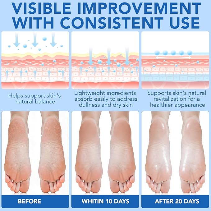 Urea Cream, Maximum Strength Urea Foot Cream, 60% Urea Cream Stick plus 2% Salicylic Acid Callus Remover for Dry Cracked Heels, Hands, Knees, Exfoliating Moisturizer, Dead Skin Remover Foot Balm 1.4OZ