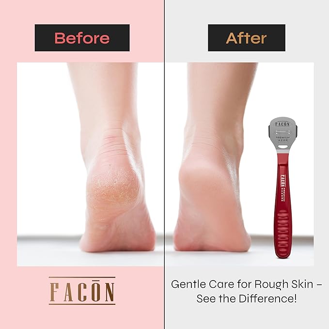 Facón Professional Callus Shaver Remover with 50 Blades, Pedicure Razor for Feet & Hands, Foot Razor for Callus Removal, Callus Blade Remover, Corn Shaver, Surgical Grade Premium Stainless Steel Tool