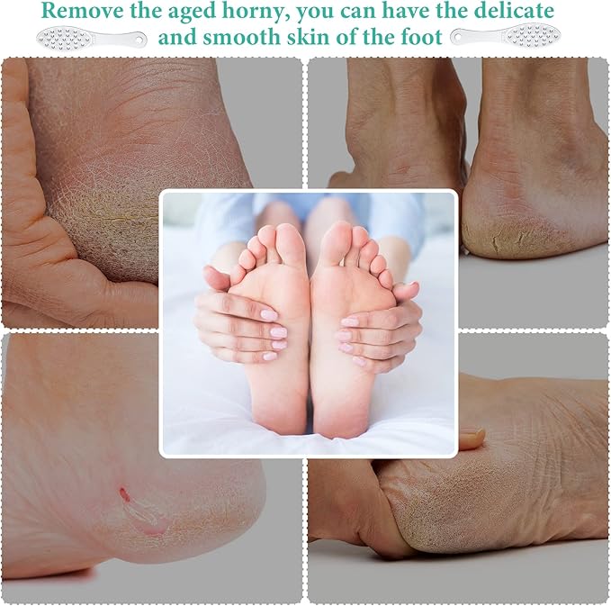 1 Pcs Stainless Steel Foot File Callus Remover Double Sided Metal Foot Rasp Scrubber for Wet or Dry Skin Professional Pedicure Tool for Hard Skin & Cracked Heels, Easy to Clean (Classic Style)