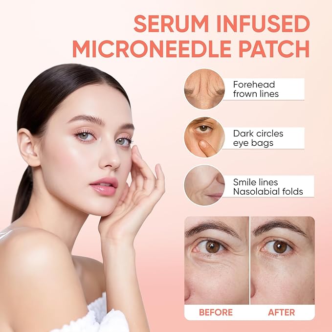 MicroGlow Eye Patches,Under Eye Patchs Hyaluronic Acid Eye Mask for Dark Circles for Women, Forehead Wrinkle & Smile Line Patches (3BOX(9 Pairs))