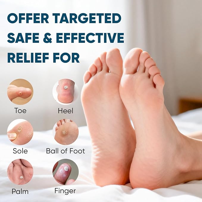 48P Corn Remover Pads for Feet and Toes, Extra Strength 40% Salicylic Acid Medicated Patches, Effective Treatment for Small Callus and Dead Skin