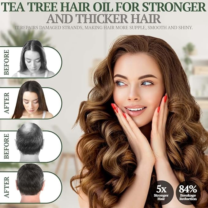 Fiora Naturals Tea Tree Essential Oil Blend, Soothing Moisturizer for Dry Scalp, Helps Hair Growth, Soothes Itchy Scalp & Fights Dandruff - Moisturizes and adds Shine - 4 fl oz